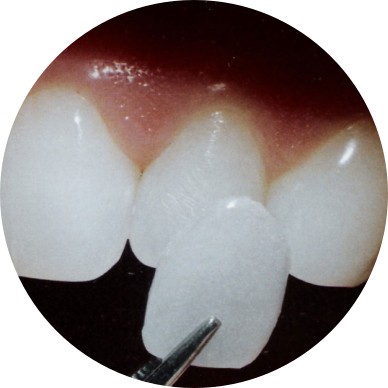 Aesthetic Dentistry - FlipCard